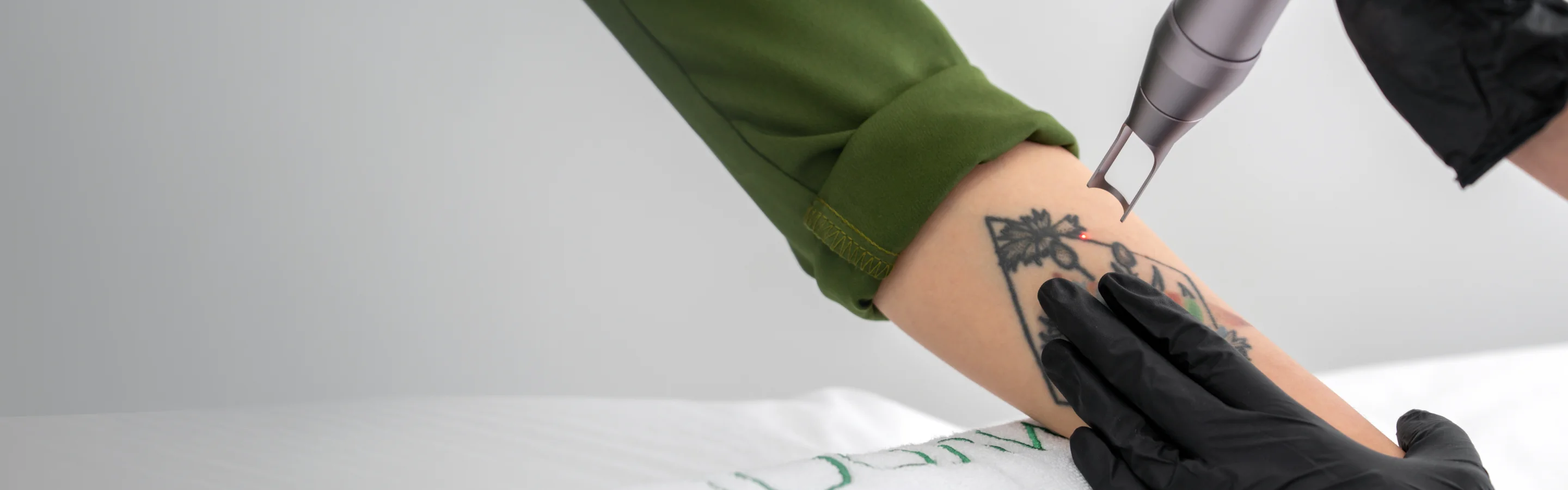 Rejuvi Non-Laser Tattoo Removal Service Dubai​​ | Select Beauty Solutions